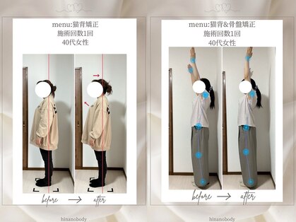 ヒナノボディ(HINANO BODY)の写真