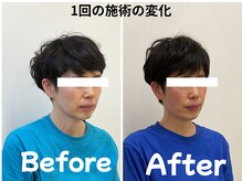 ゆず鍼灸整骨院/