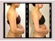 ソウ バイ ソウ(So by 蒼)の写真/【ゴツさや厚みでお悩みの方◎】他で変わらなかった体型を最短で大変身！日本唯一の技術で最強の華奢ボディ