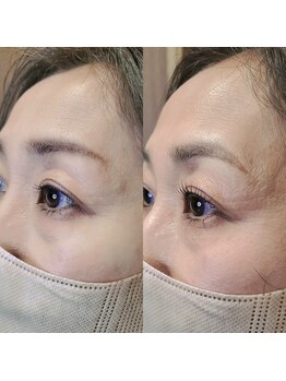 パーソナルアイラッシュ(PERSONAL EYELASH)/まつ毛パーマ