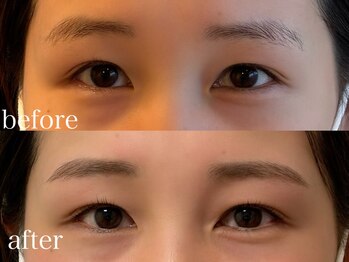 ユーロ(EURO)/ラッシュリフト＆アイブロウ