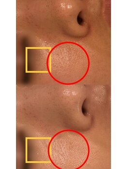 セレニテ(Serenite)/