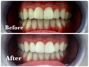 スリーラック 伏見桃山店(THREE LUCK)/初回限定無料体験コース¥0(60分)