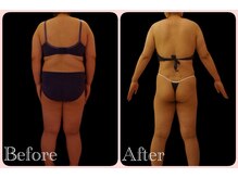 トータルビューティサロン クイーン(Queen)/エンダモロジー