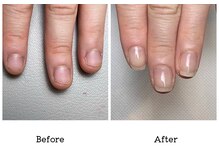 アンベリール(embellir.)/自爪・深爪育成