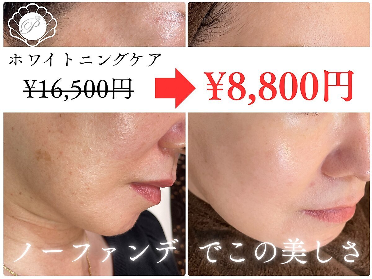 お肌をきれいにしたい！茅ヶ崎・辻堂で人気のエステ,脱毛,痩身サロン