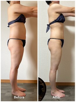 エレナ(Elena)の写真/ストレス社会の為暴飲暴食！食事制限、運動は苦手でも6ヶ月で【－10kg】に成功！！