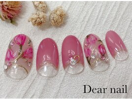 チューリップ×逆フレンチ