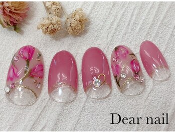 ディア ネイル(Dear nail)/チューリップ×逆フレンチ