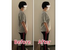ほぐし屋さん/猫背の姿勢が一回でここまで変化