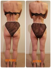 サロン ドゥ メビウス 春日店(salon de mebius)/筋膜リンパでむくみスッキリ