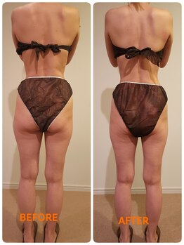 サロン ドゥ メビウス 春日店(salon de mebius)/筋膜リンパでむくみスッキリ