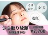 シミケアし放題【痛みに弱い方も◎】お顔全体30分　初回￥7700