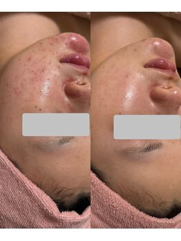 ソルティ サロン(salty salon)/ララピール＋LDM