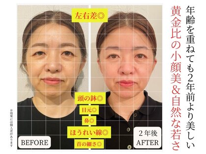 ロシュニの写真