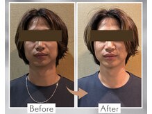 東船橋スタンス整体院の雰囲気（【メンズ美容】みんなやってます。『パパかっこいい』は作れます）