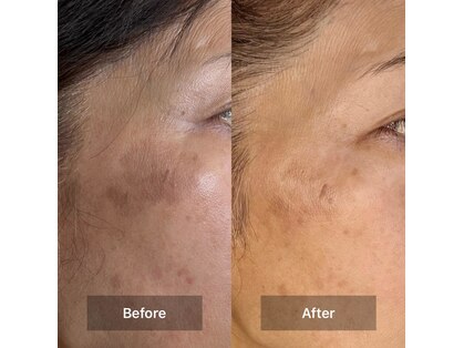 エミオン(EMION)の写真