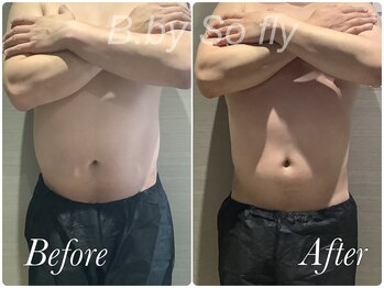 ビードット バイ ソーフライ(B.by So fly)/オーダーメイド痩身☆