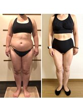 ソフィアアイズ 倉敷店(SOPHIAEYES)/エステプロラボでのダイエット