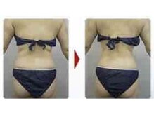 ブランシェ 高岡店 × 椿/筋膜セラピー効果