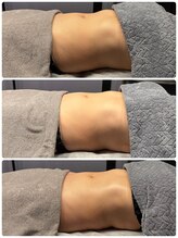 ロザリー(ROSALY)/腸もみＢ＆Ｆ