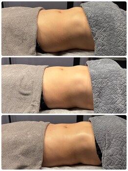 ロザリー(ROSALY)/腸もみＢ＆Ｆ