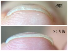 ベルチエロ(Bel cielo)の雰囲気（巻爪矯正メニュー有◎痛みがほぼない巻爪矯正です！）
