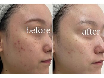 ラポール 野並店(Rapport)/