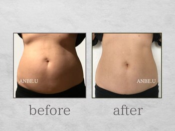 アンビーユー(ANBE.U)