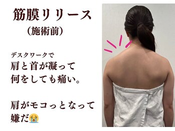 トータルセラピー リッチ(Rich)/宮崎市 肩こり
