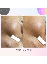 レジュイール(Rejouir)/