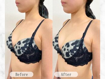 ルルミリ 心斎橋(Lulumili)/ふっくらバストアップ