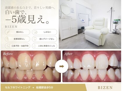 ビゼン(BIZEN)の写真