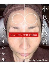 シン(Shin)/【小じわ改善フェイシャル】