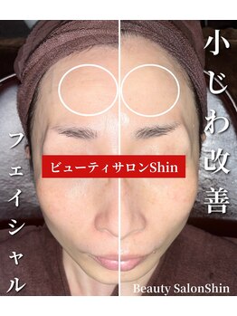 シン(Shin)/【小じわ改善フェイシャル】
