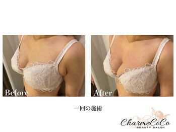 シャルムココ 蔵前店(CharmeCoCo)/お客様Before→After