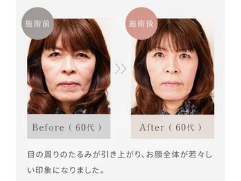 リアンシャンテ(Re enchanter)