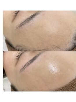 L.アイラッシュアンドビューティー/