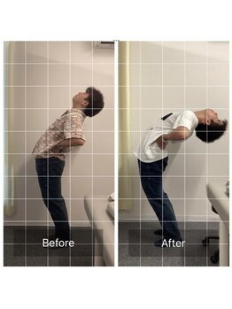 大阪茨木市駅前整体院/腰痛改善♪