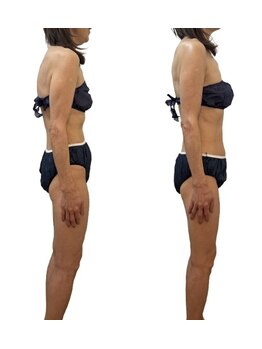 佳園/筋膜矯正NMTオイルセラピー