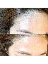 ハウオリ(Hauoli)/コンプレックスだったおでこも