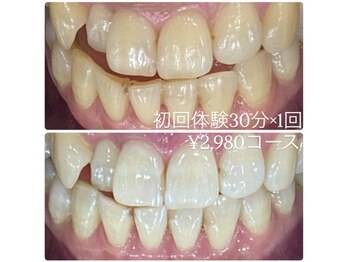 ホワイトニングルーム 横浜店(Whitening Room)/セルフホワイトニング/横浜