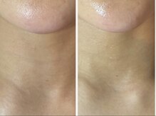 ドゥナ(DUNA)/『新メニュー』ディープリフト