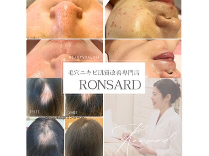 ロンサール(RONSARD)の写真