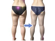 ヨサパーク リノ(YOSA PARK Lino)の雰囲気（内側から巡りを整えて、セルライトケア＆すっきりボディへ♪）