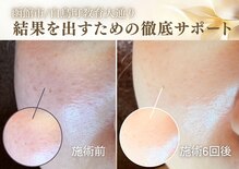 グラチア(Gratiae)