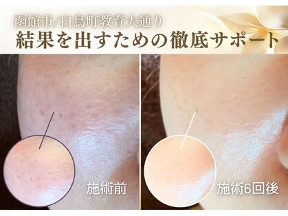 グラチア(Gratiae)の写真