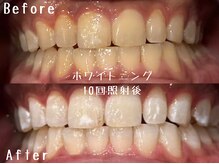 アデル 久留米(ADEL)の雰囲気(自信のある笑顔に!初回体験クーポン有り♪)