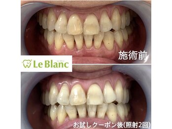 ルブラン 奈良店(Le Blanc)/1日2回連続ケア迄可能です!