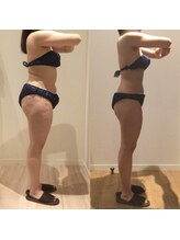 アユアランリンク 札幌中島公園店/C様：側面